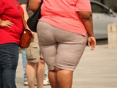 obese woman