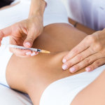 HCG Injection